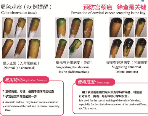 醫(yī)保產(chǎn)品： 宮檢1號(hào) （宮頸癌快速篩查）