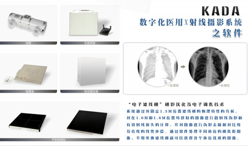 X射線(xiàn)攝影系統(tǒng)全部3_05