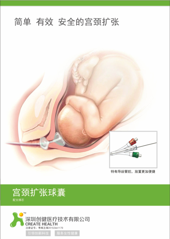 產(chǎn)科耗材子宮頸擴(kuò)張球囊   全國(guó)招商
