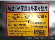 鑫俊公司專業(yè)供應柯達醫(yī)用膠片