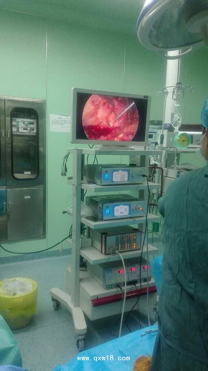 德國(guó)MGB高清腹腔鏡，高清膀胱鏡，高清輸尿管腎鏡，鼻竇鏡