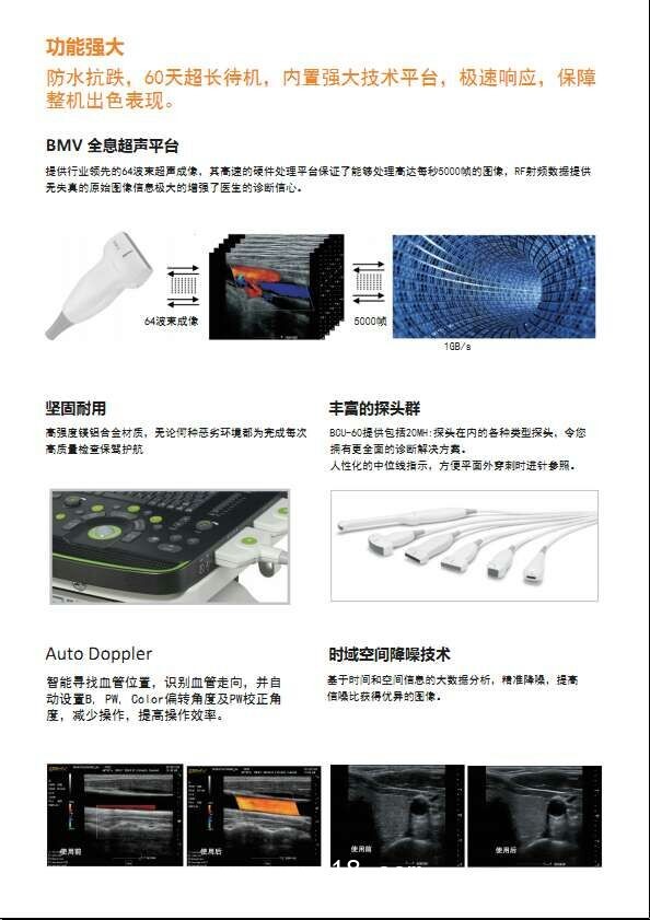 B超，監(jiān)護儀，心電圖，血壓計