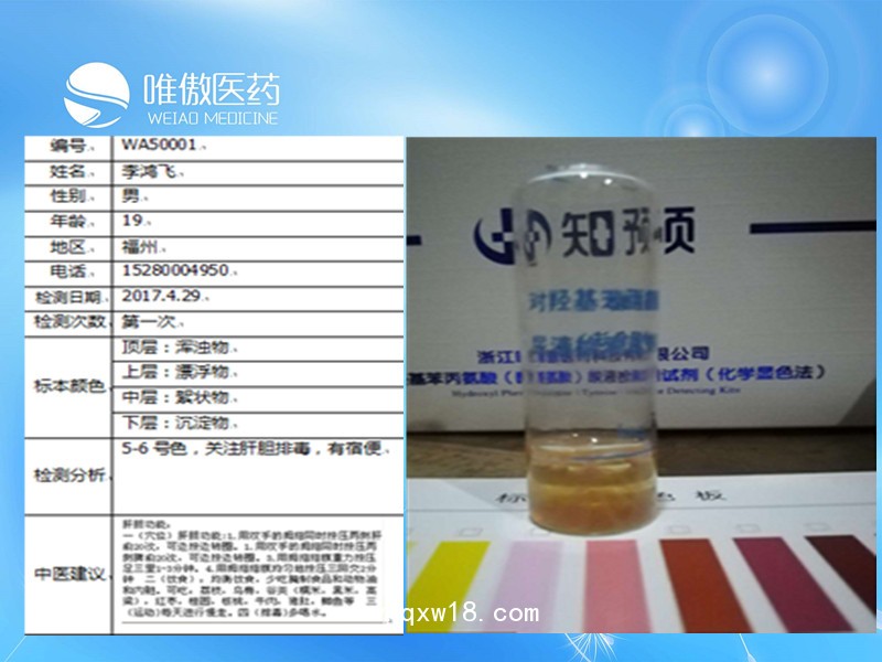 熱休克蛋白90α定量檢測試劑盒