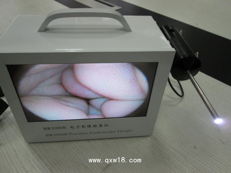 內(nèi)窺鏡