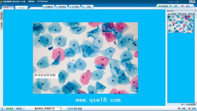 液基薄層細胞學(xué)檢測系統(tǒng) TBS TCT液基圖文報告系統(tǒng)軟件