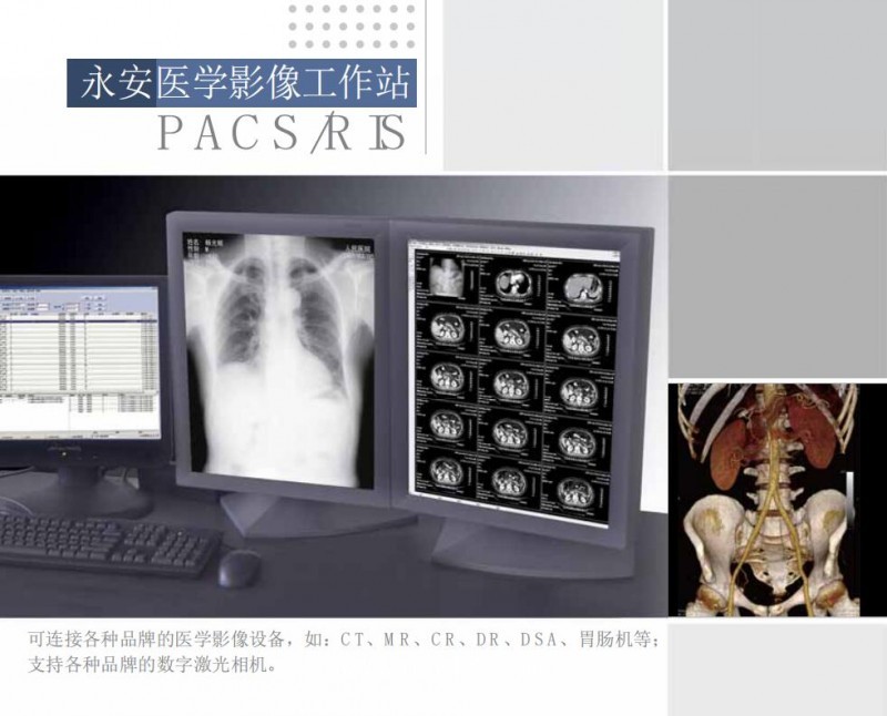 影像工作站（超聲、DR、CT、核磁）軟件廠家