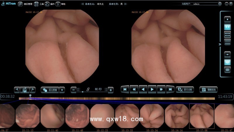 供應Hitron膠囊內鏡 膠囊內窺鏡 膠囊式內窺鏡系統
