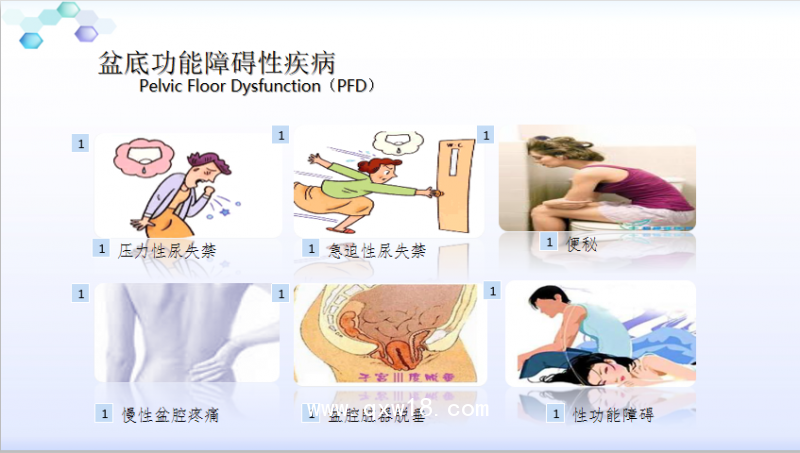 盆底功能性疾病有哪些