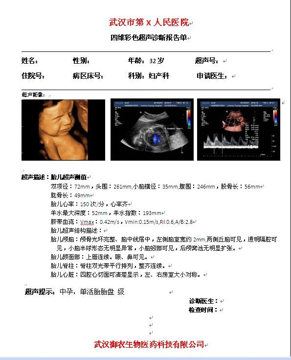 醫(yī)用膠片