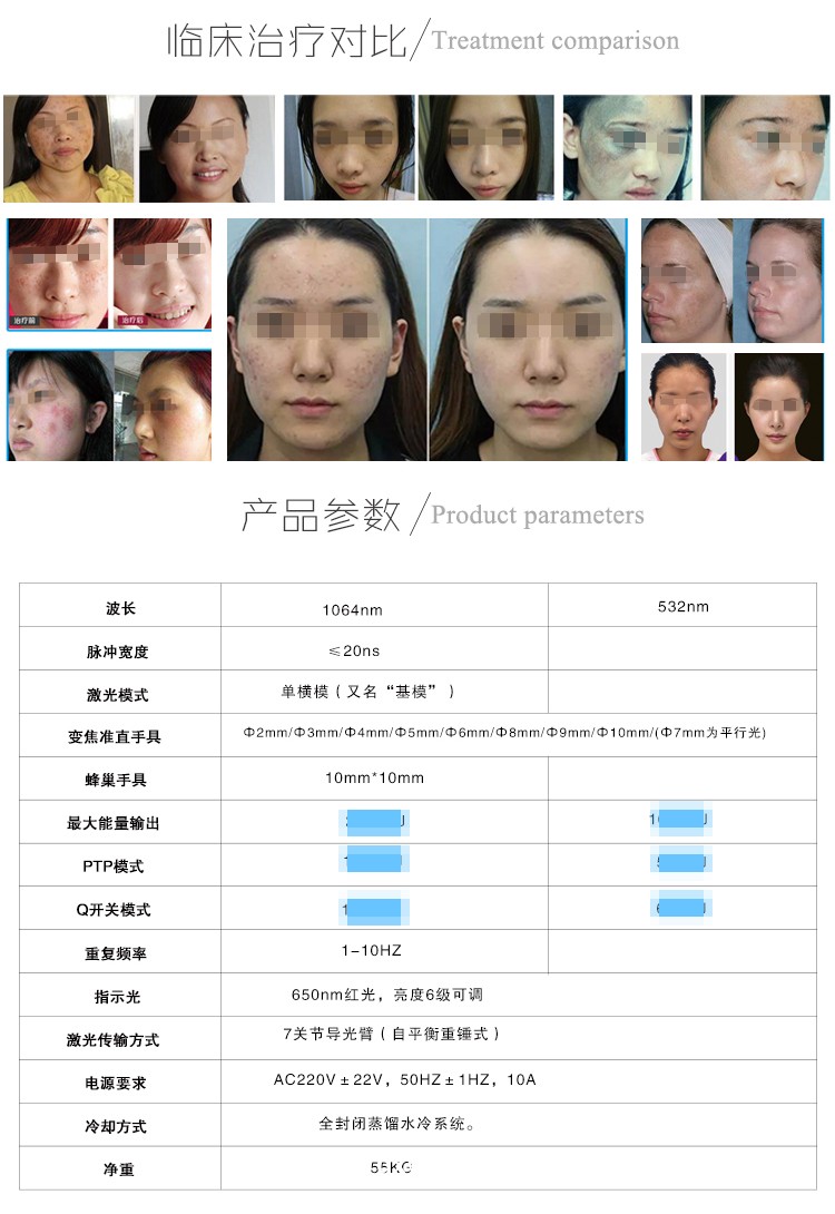 調q激光治療儀皮膚科激光治療儀關于調q激光治療雀斑
