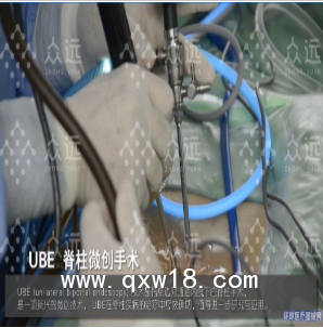 UBE器械包，UBE融合器械包，UBE大直徑消融電極