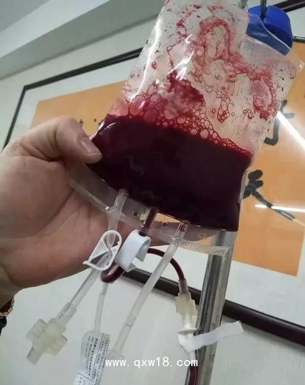 一次性大自血血袋，一次性輸血器，醫(yī)用臭氧儀等耗材產(chǎn)品批發(fā)
