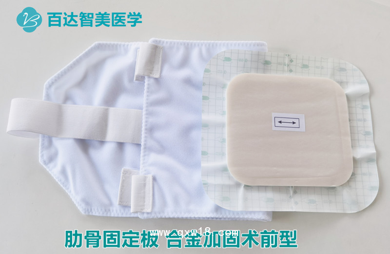 肋骨固定板合金加固術(shù)前型200