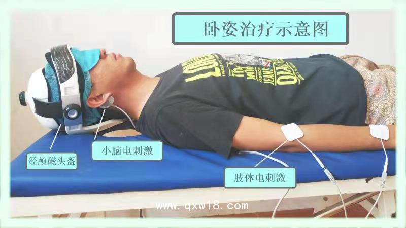 初鴻腦循環(huán)功能障礙治療儀BW-6911腦循環(huán)障礙腦功能治療儀