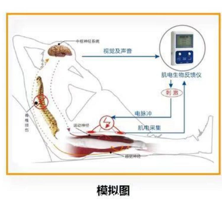 諾誠(chéng)肌電生物反饋儀 XCH-B2
