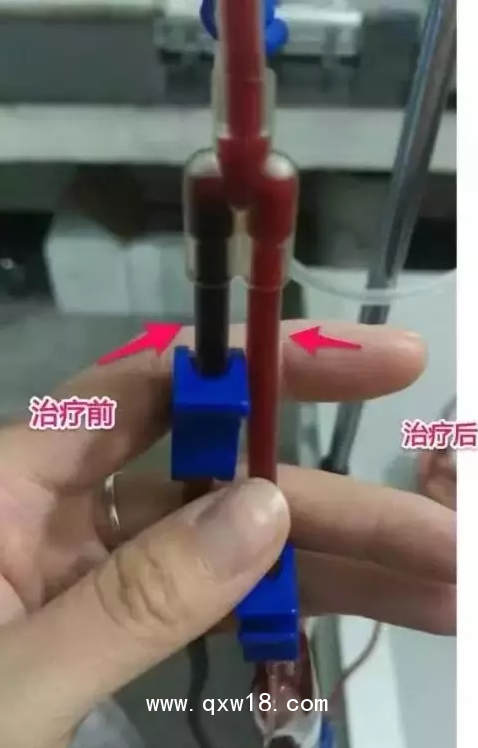 醫(yī)用臭氧治療儀 臭氧治療儀適應癥 臭氧治療儀廠家排行