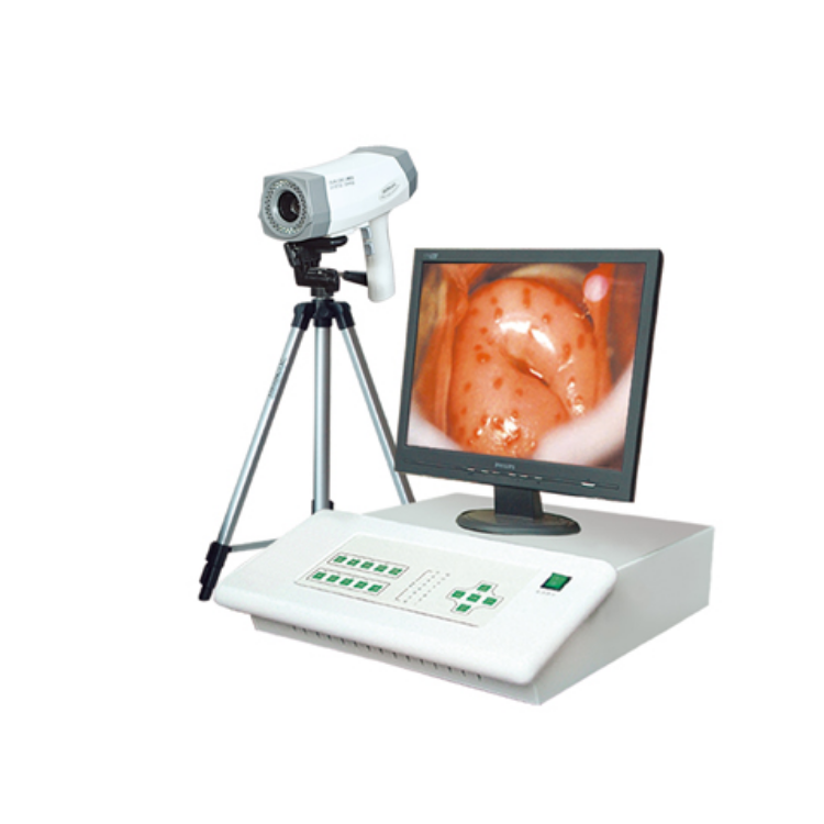 數(shù)碼電子陰道鏡 臺(tái)式陰道鏡BX-8100I、BX-8100II