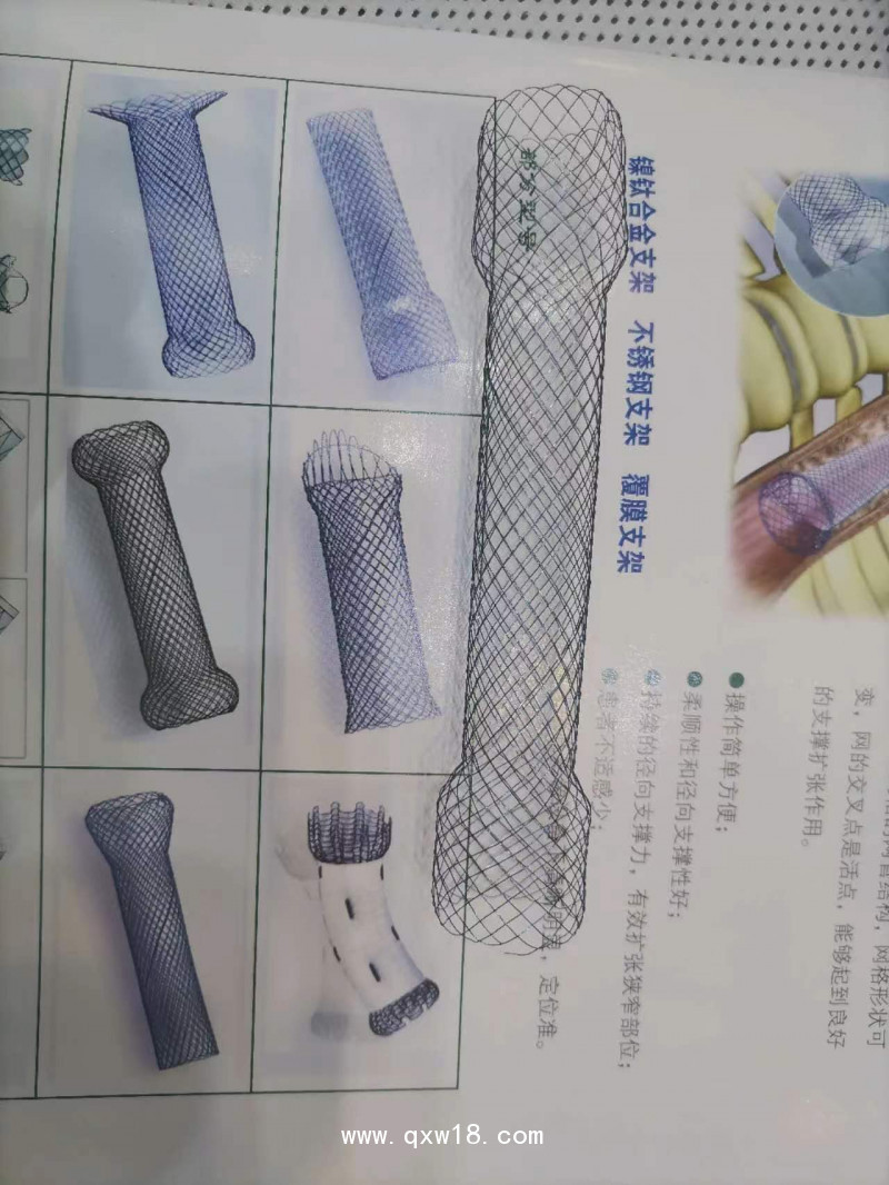 覆膜膽道支架、膽管