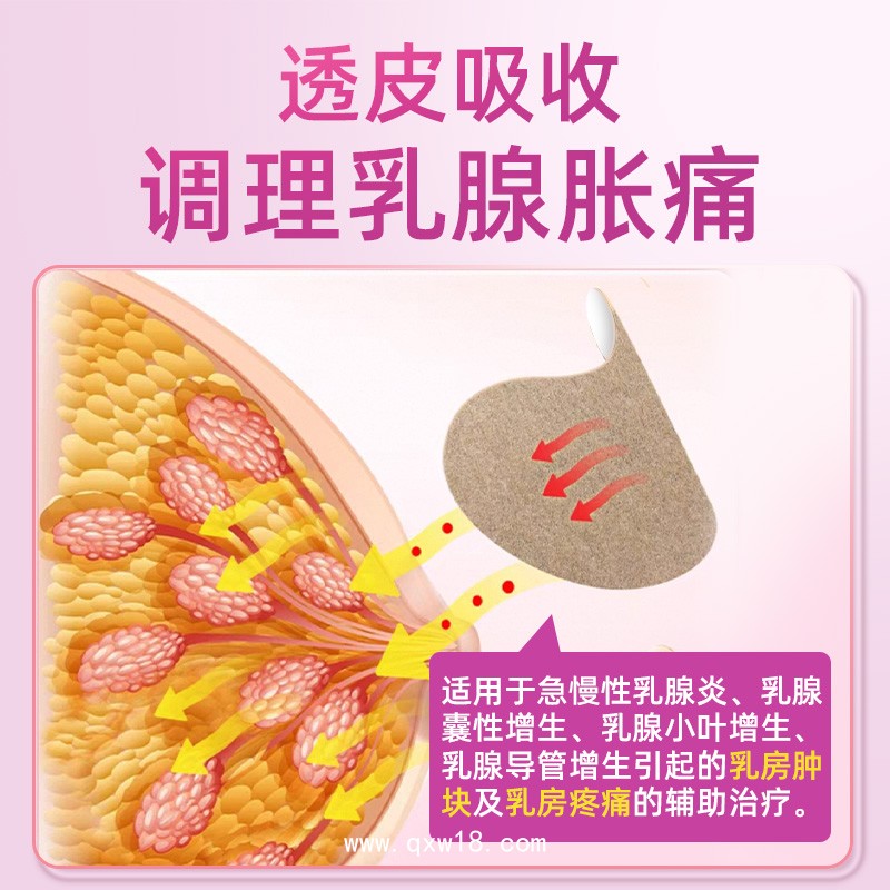 乳腺貼通乳貼穴位貼敷治療貼OEM貼牌代加工廠家