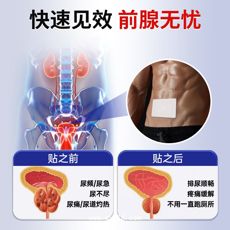 遠(yuǎn)紅外理療貼男性慢性前列腺炎腰痛尿頻尿急尿失禁二類械字號貼牌