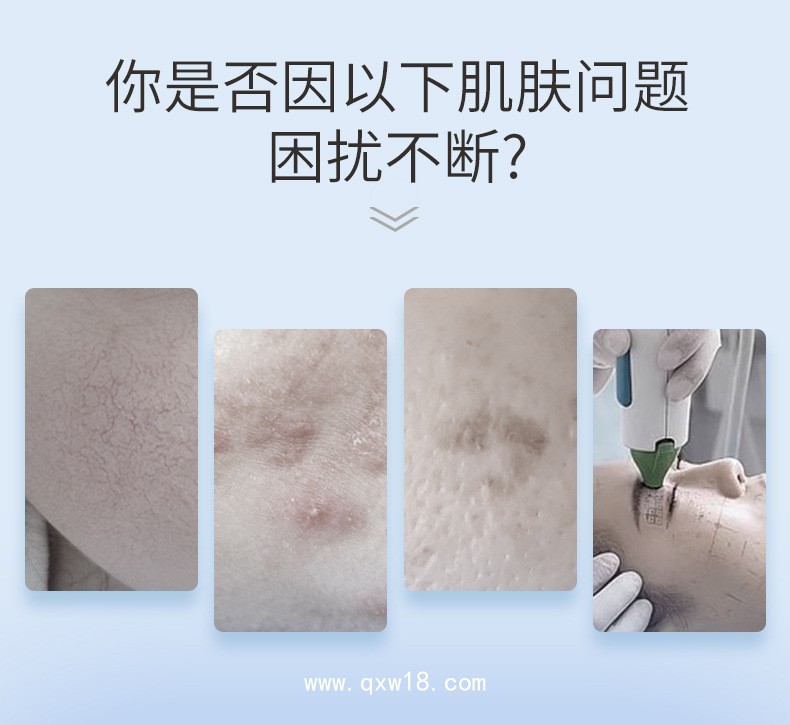 重組Ⅲ型人源化膠原蛋白敷料貼生產(chǎn)廠家 定制無菌械字號(hào)醫(yī)用冷敷貼
