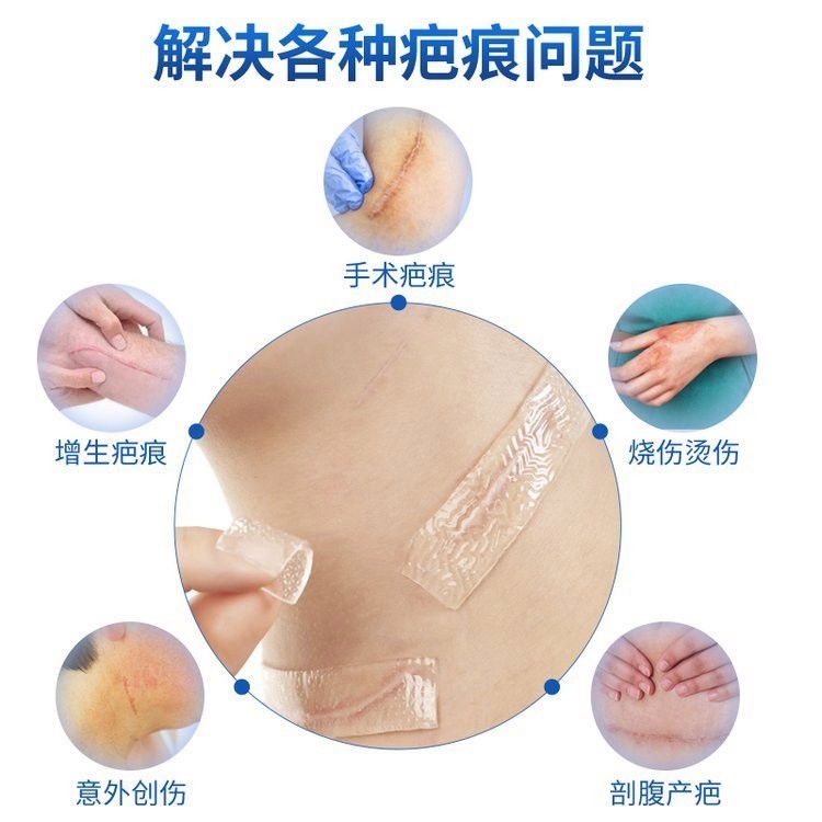 醫(yī)用疤痕貼/醫(yī)用疤痕貼加工/醫(yī)用疤痕貼OEM貼牌
