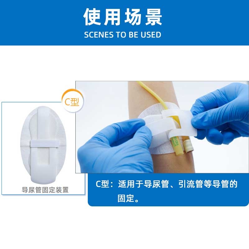 體表導(dǎo)管固定貼 固定牢靠可定制代加工