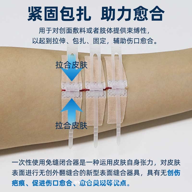 醫(yī)用傷口免縫針 單排多排扣 可定制