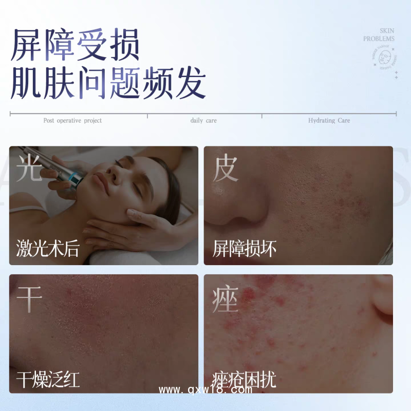 透明質(zhì)酸鈉敷料 現(xiàn)貨批發(fā)二類(lèi)械字號(hào)院線非面膜醫(yī)用冷敷貼廠家