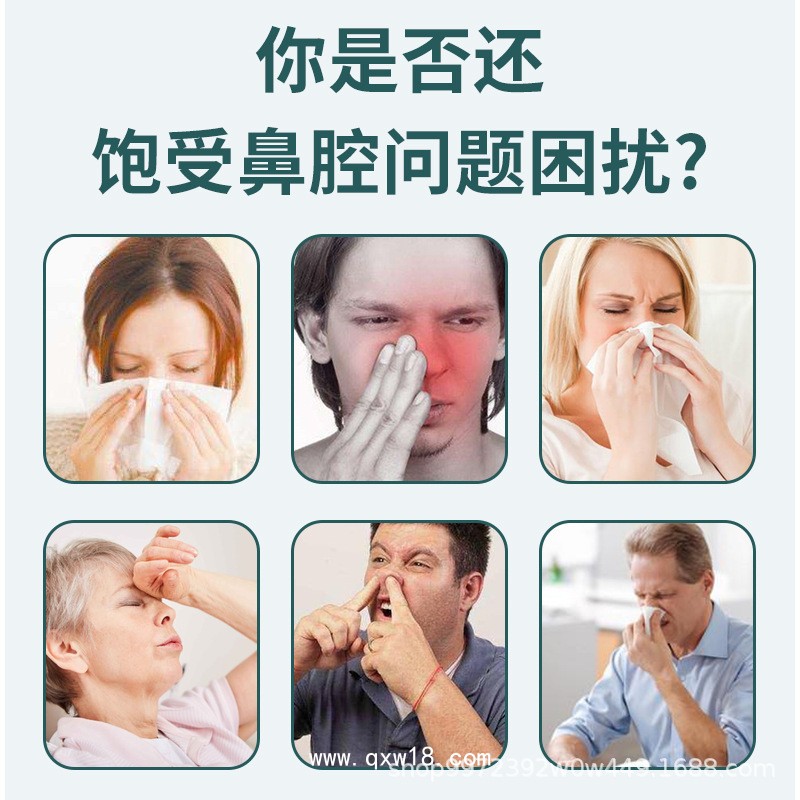 舜達全康穴位貼敷治療貼（鼻炎穴位貼）二類醫(yī)療器械
