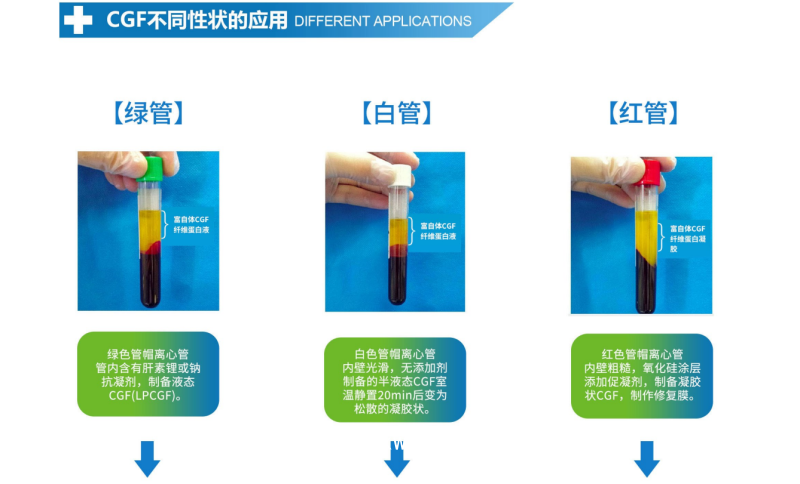 CGF 制備管 提取管  血液采集管 分離管 一次性人體靜脈血樣采集容器