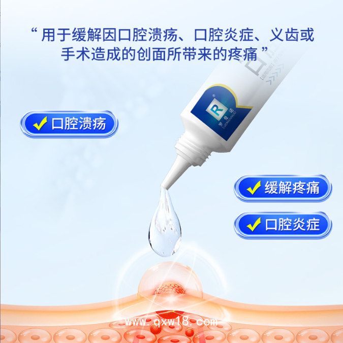 口腔潰瘍凝膠緩解口腔黏膜嘴起泡炎癥義齒術(shù)后腫痛護(hù)理凝膠