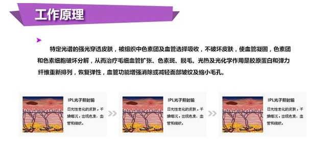工作原理.jpg