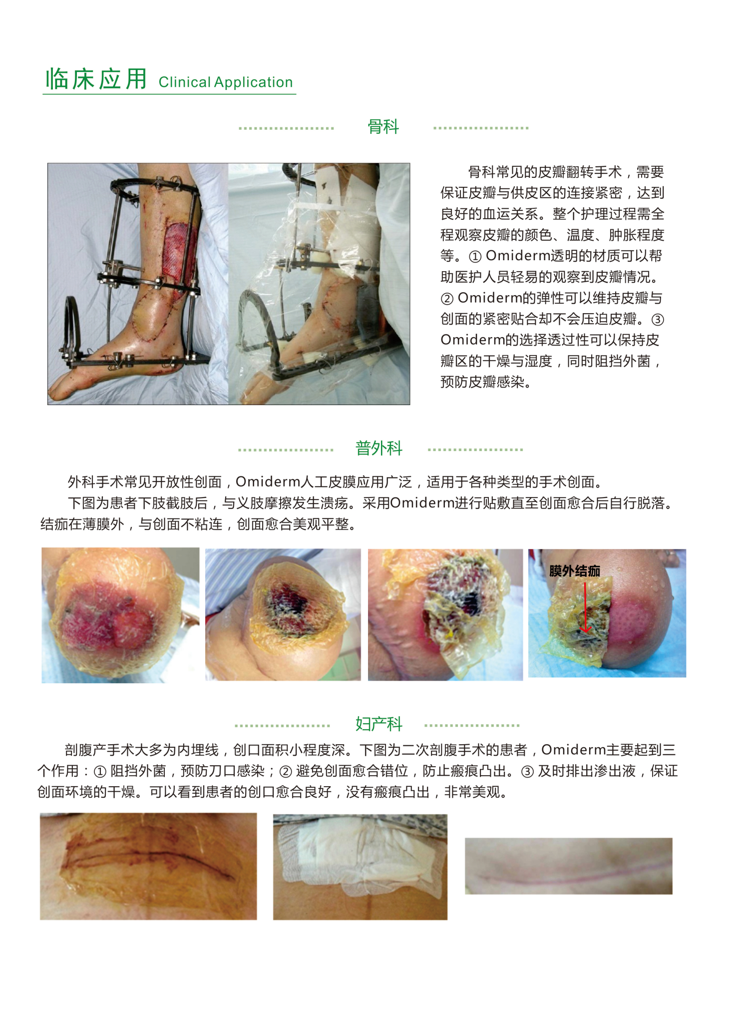 皮膜4_編輯.jpg