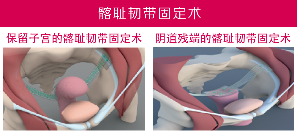 未標題-2.png