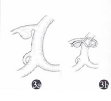 43.png
